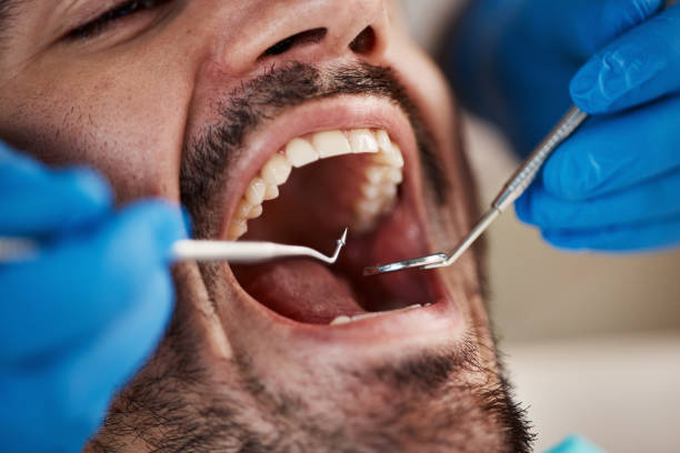 Best Emergency Root Canal Treatment in Hammond, WI