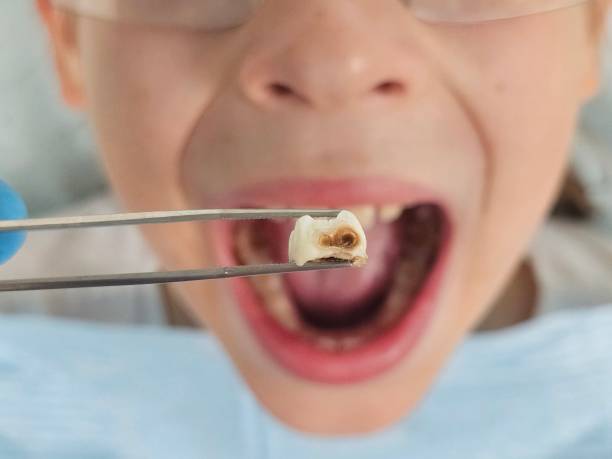 Best Walk-In Emergency Dentist in Hammond, WI