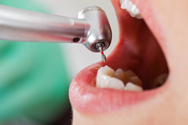 Best Emergency Broken Tooth Repair in Hammond, WI